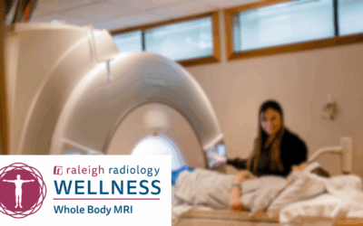 A full-body MRI could catch disease early. Is it worth the $3,000 cost? NC experts weigh in