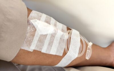 Do You Need Contrast for Your CT Scan?